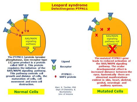 LEOPARD Syndrome | Hereditary Ocular Diseases