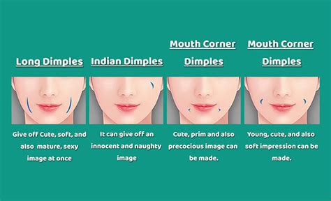 Chin Dimple Removal