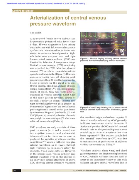 (PDF) Arterialization of central venous pressure waveform