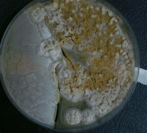 Culture of Epidermophyton floccosum | Download Scientific Diagram