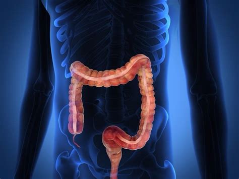 Colonoscopy - Everything you need to know about the procedure