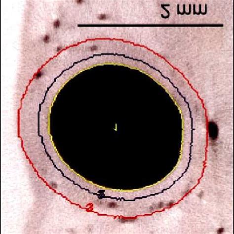 (a) Vasa vasorum histology (reprinted from [9]) in relation to (b) a ...