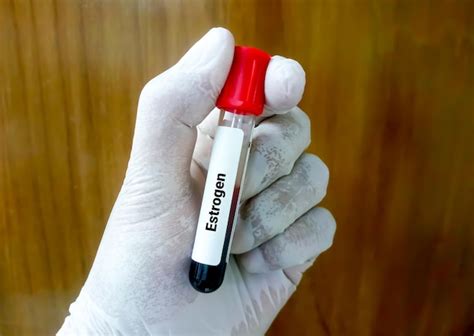 Premium Photo | Blood sample for estrogen or estradiol hormone test