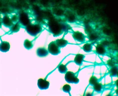 Mold (Bread, Fruiting Bodies) Prepared Microscope Slide