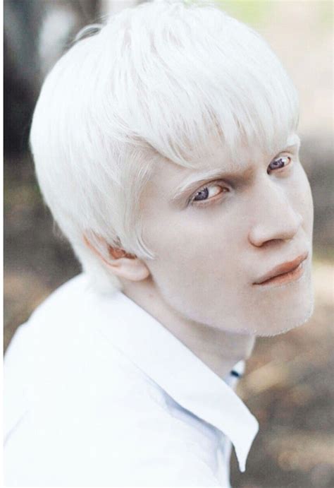 Snow Queen, Albino Human, Modelo Albino, Albino Model, Vitiligo Treatment, Melanism, Character ...