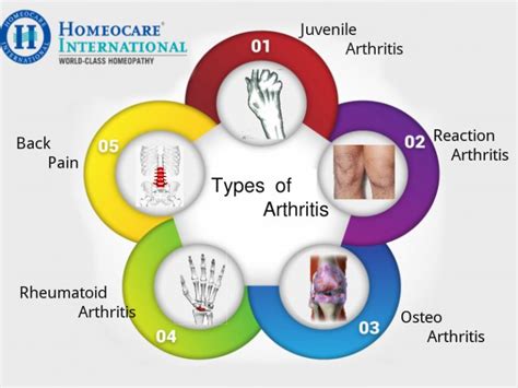 Difference between Joint pains and Arthritis