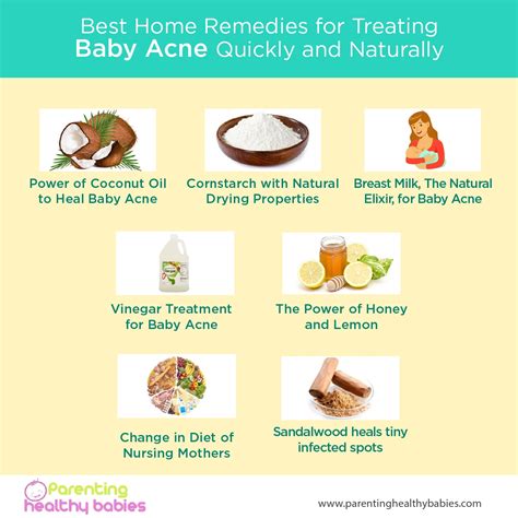 Ultimate Guide for Treating Baby Acne Naturally: Home Remedies