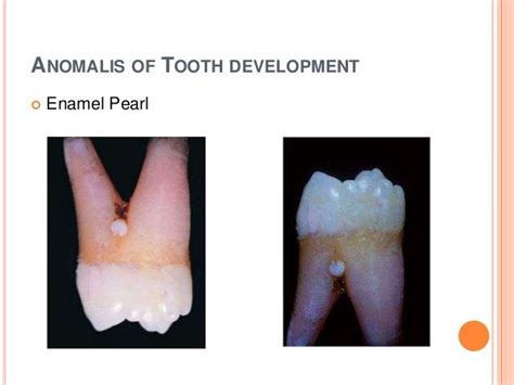 Tooth development part 2