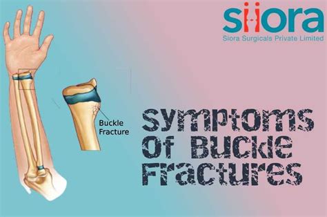 Buckle Fractures in Children - A Detailed Guide