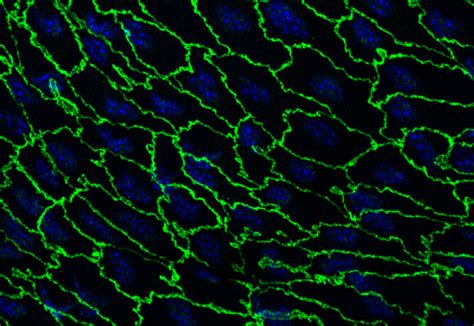 Michael Gimbrone - The role of VE-cadherin in vascular permeability - IFOM Review