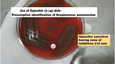 Use of Optochin sensitivity in Microbiology - YouTube