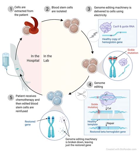 Discovery and development of a CRISPR-based therapy for sickle cell disease - Innovative ...