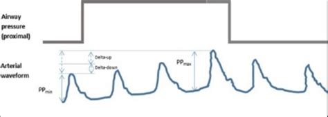 Pulse pressure variation (Increase in pulse pressure at the end of... | Download Scientific Diagram