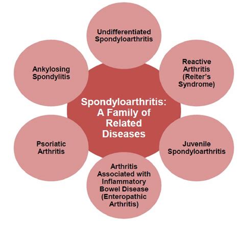 About Spondyloarthritis | Living with Spondyloarthritis