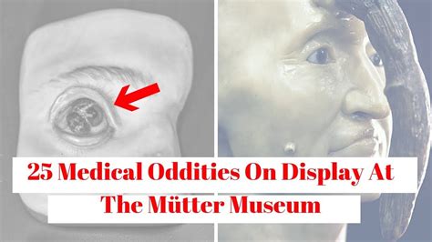 25 Medical Oddities On Display At The Mütter Museum – memes