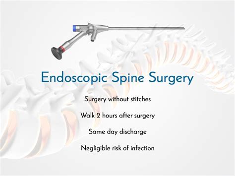 Endoscopic Spine Surgery, Slipped disc, Spinal fusion surgery, Mumbai