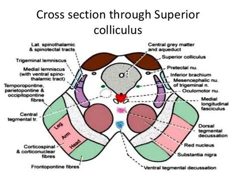 Transverse section through Inferior colliculus Gross Anatomy, Human ...