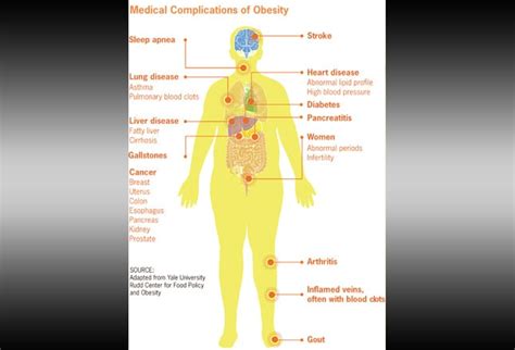 Growth Disorders: 10 Cases of a Developing Problem