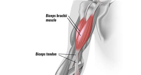 Biceps Tendonitis at the Elbow - Symptoms, Causes & Treatment.