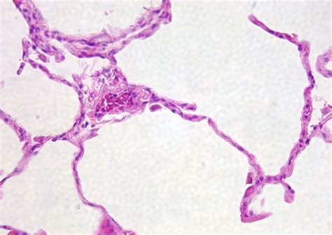 SIMPLE SQUAMOUS EPITHELIUM. lots of open space, again looks like thick ...