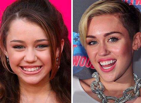 Miley Cyrus Overbite