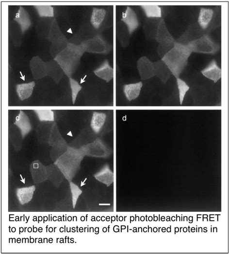 Structure, dynamics, and function of rafts in cell membranes - Dr. Anne ...