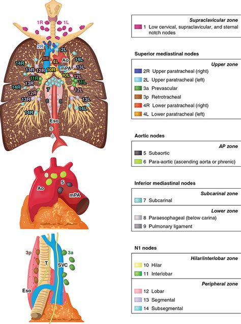 Staging of Lung Cancer | Thoracic Key