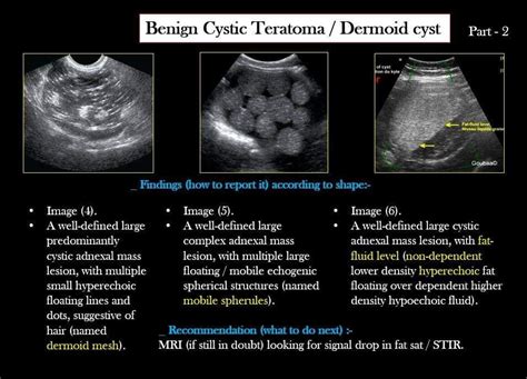 Pin by Grace Ortiz on Ultrasound | Diagnostic medical sonography, Ultrasound sonography, Ultrasound