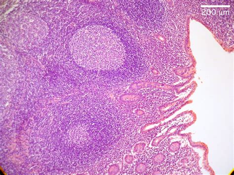 HISTOLOGY, Lymphatic Lab, Appendix slide | Lymphatic, Appendix, Medical science