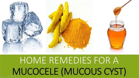 Home Remedies for a Mucocele (Mucous Cyst) | Home Remedies To Treat Mucocele - YouTube