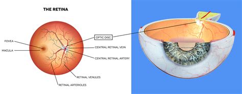 Optic Disc | Eye Patient