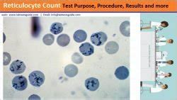 Reticulocyte Count Principle, Procedure, Calculations and more | Lab Tests Guide