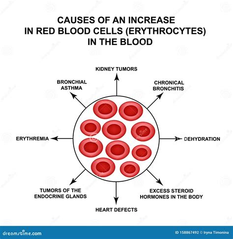 Causes of Increased Red Blood Cells. Cells Erythrocytes. Hemoglobin. the Structure of Red Blood ...