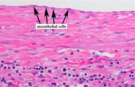 Mesothelium Histology