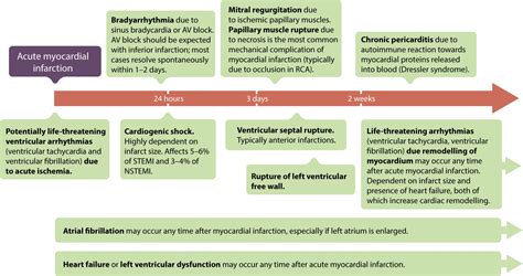 STEMI (ST Elevation Myocardial Infarction): diagnosis, criteria, ECG ...