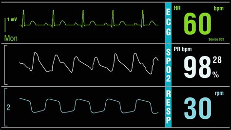 MONITORING-SPO2 Footage, Videos and Clips in HD and 4K - Avopix.com