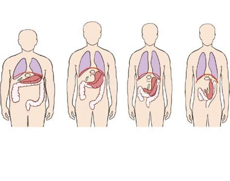 Body Habitus (Rad 107-1) Quiz