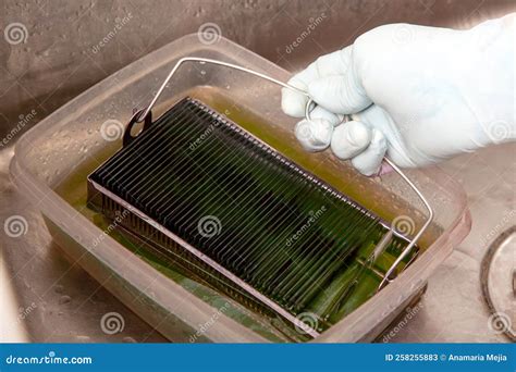 Scientist Staining Microscope Slides for Cytology Studies in the Laboratory Stock Image - Image ...