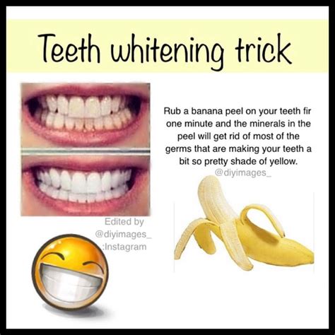 How Does A Banana Peel Whiten Your Teeth - Banana Poster