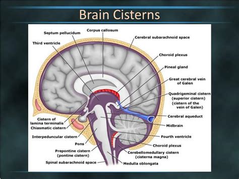 PPT - Brain Cisterns PowerPoint Presentation - ID:2263744