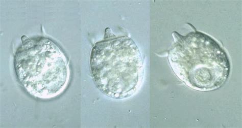 Protist Images: Didinium