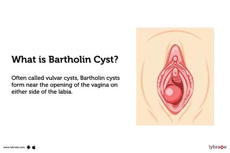 Bartholin Gland Duct