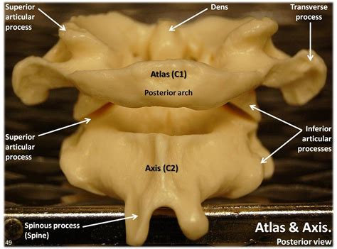 Atlas C1 and Axis C2 vertebrae, posterior view with labels… | Flickr