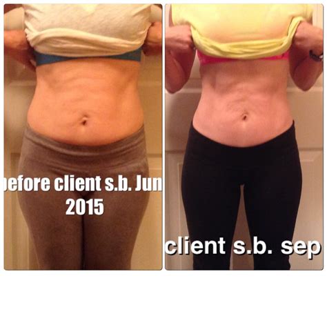 All New Before and After Pictures – Healing the Diastasis Recti 2015 – Beautiful After the Belly