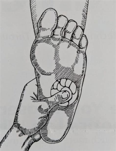 Cuboid Syndrome - Paragon Orthotic Laboratory