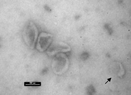 Exosomes: Fit to deliver small RNA | Exosome RNA