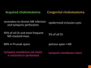 Middle ear cholesteatoma - imaging findings | PPT