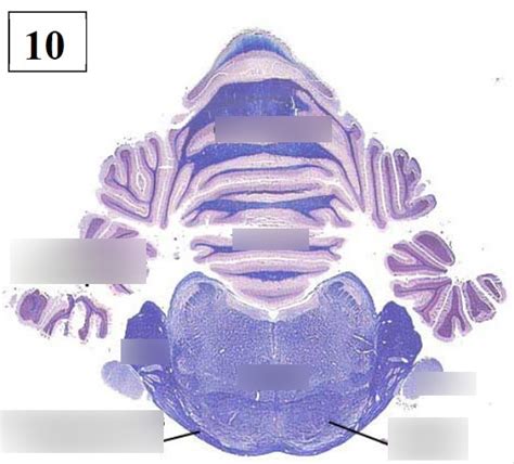 Development of the Metencephalon Diagram | Quizlet