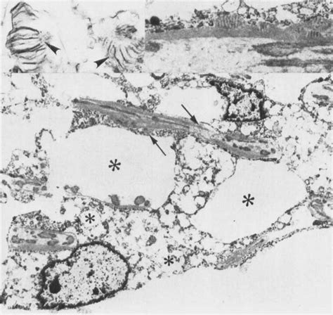 Endothelial cells of the trabecular meshwork are considerably distended... | Download Scientific ...