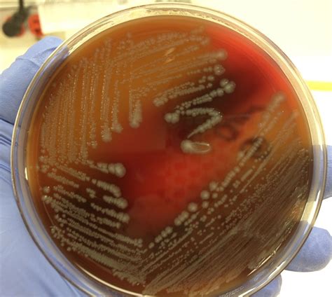 E. coli Microbiology Lab, Lab Tech, Fungi, Bacteria, Growth, Notes, Culture, Media, Shapes